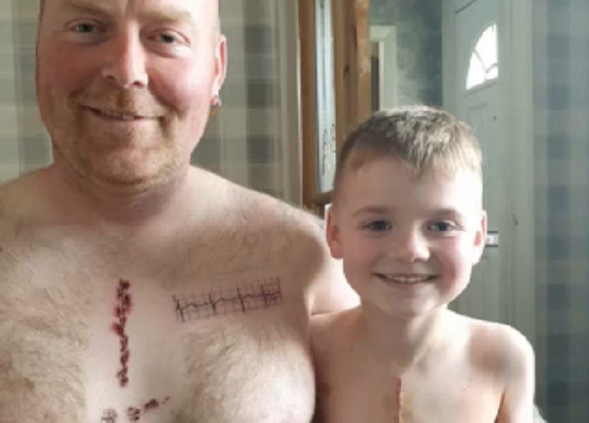 Un papa se fait tatouer la cicatrice de son fils qui a permis de lui sauver la vie