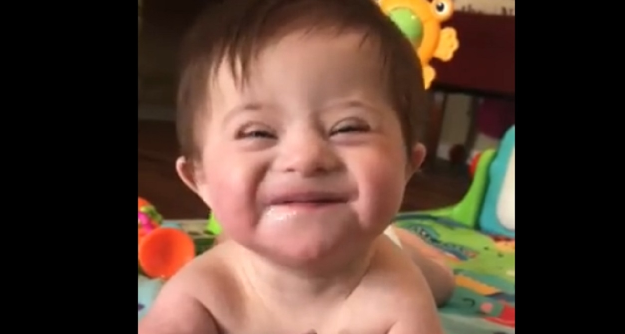 Un bb atteint du syndrome de Down clate de rire avec sa nouvelle maman adoptive